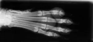 A digital x-ray of a dog's foot. The x-ray shows the bones and joints of the foot in great detail. The x-ray is in black and white and has a high contrast.